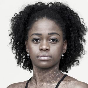 MichaelaDePrince.jpg